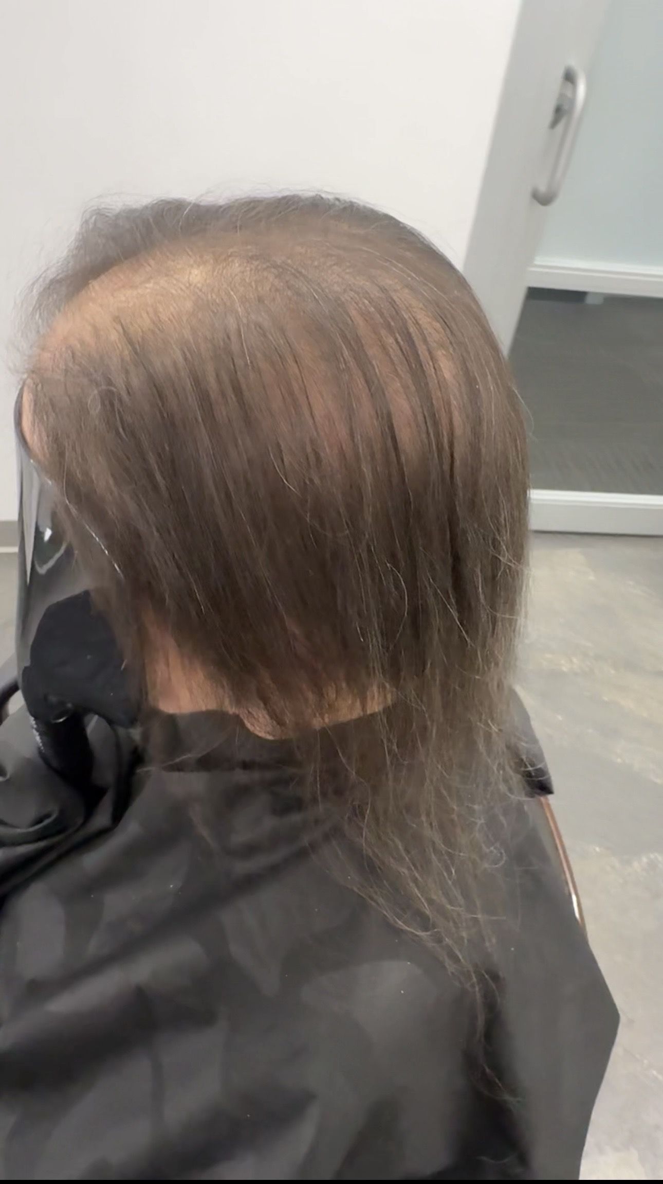 Before and after example - before